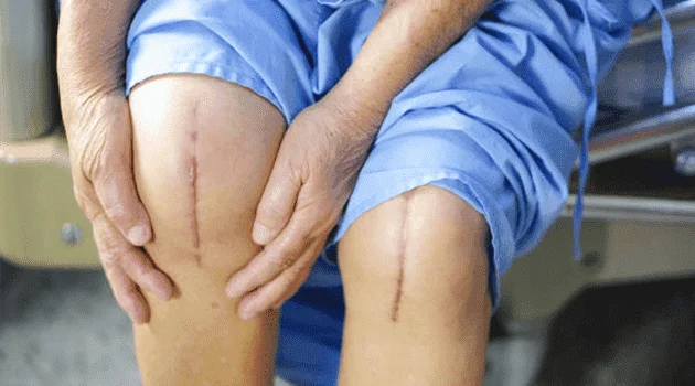 Knee Replacment Care at Home